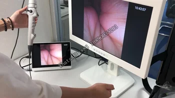 LHBF Китай Эндоскопический бронхоскоп HD-типа Медицинский эндоскоп Риноларингоскоп портативный видео